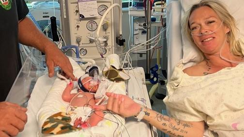 An Imbil family have put a call for help out through a GoFundMe after their newborn had open-heart surgery within a day of a birth which threatened both his mother and his own life. Samantha Peake (mother), David Myers (father) and Leo Allan Myers. Picture: (supplied)