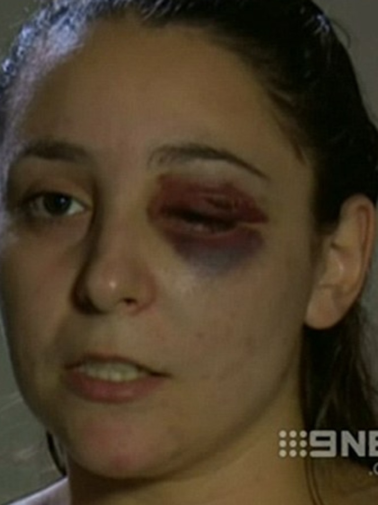 Ms Hotait told media she feared for her life. Picture: Supplied