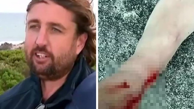 Surfer Ryan Lowther describes the terrifying moment he was bitten by a shark at Trigg Beach in Perth. Picture: 7NEWS.