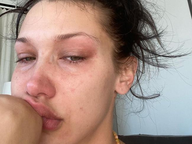 Bella has recently lifted the lid on her ‘excrutiating’ struggle with mental health. Picture: Instagram/bellahadid