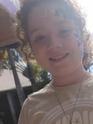 Daniella Jacobs-Herd suffered serious burns in an incident at her Urangan home.