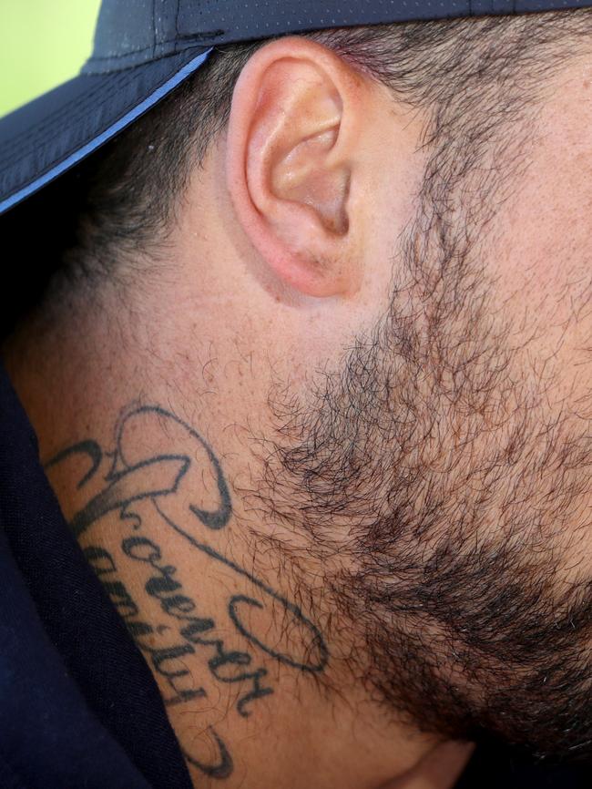 BEFORE: The neck tattoo is prominent before treatment.