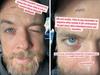 Hamish posts pics after emergency surgery