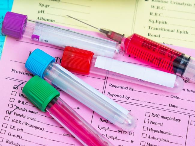 Cancer will soon be screened by a simple blood test. Picture: Getty Images