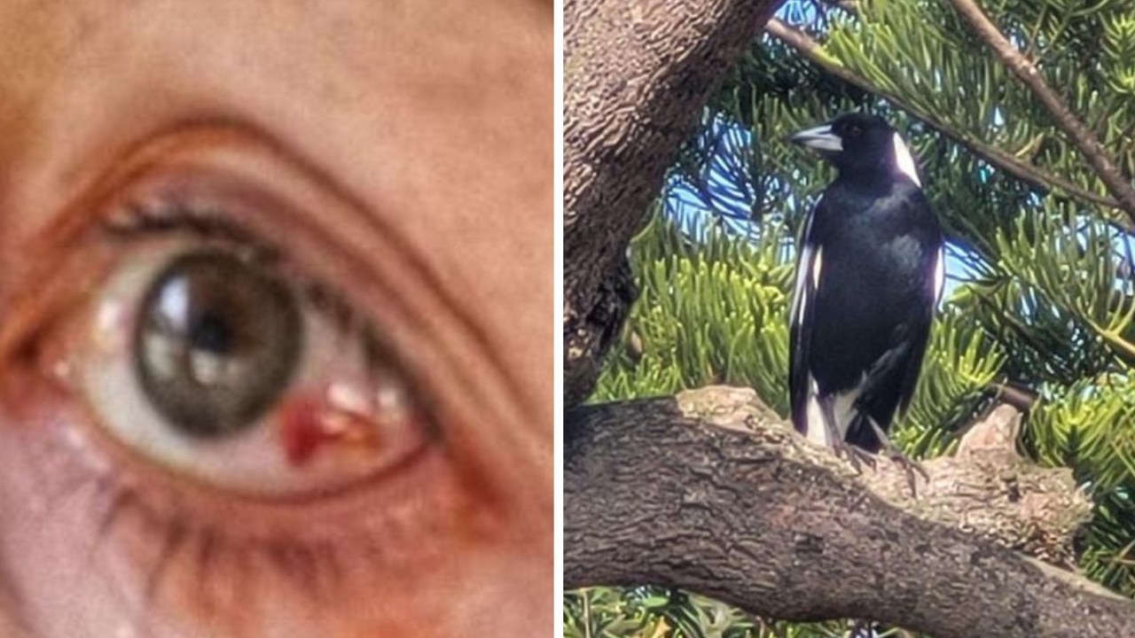 Mum’s horror injury after magpie attack