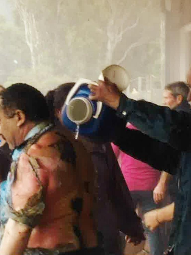 Firefighter Joe Torrisi has water poured over his badly burned skin after the explosion. Picture: Supplied.