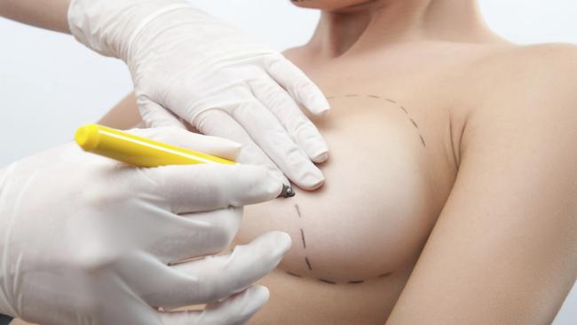 Cut-price breast implants have been linked to five cancer clusters around Australia.