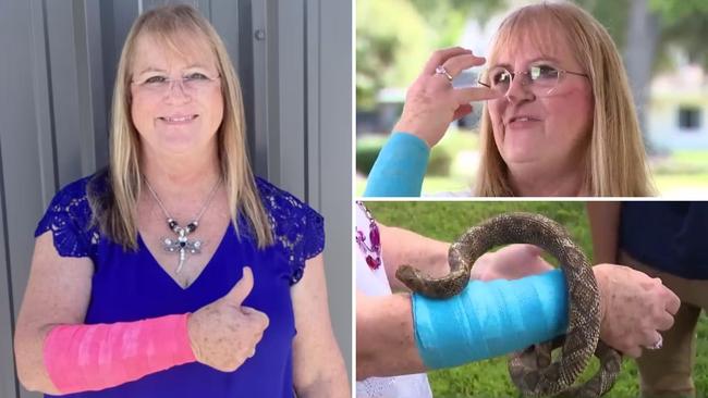 Woman attacked by snake and hawk at same time