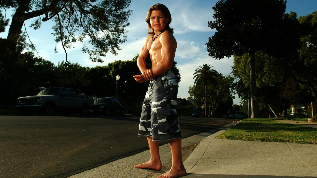 ‘World’s strongest’ boy’s life 25 years on