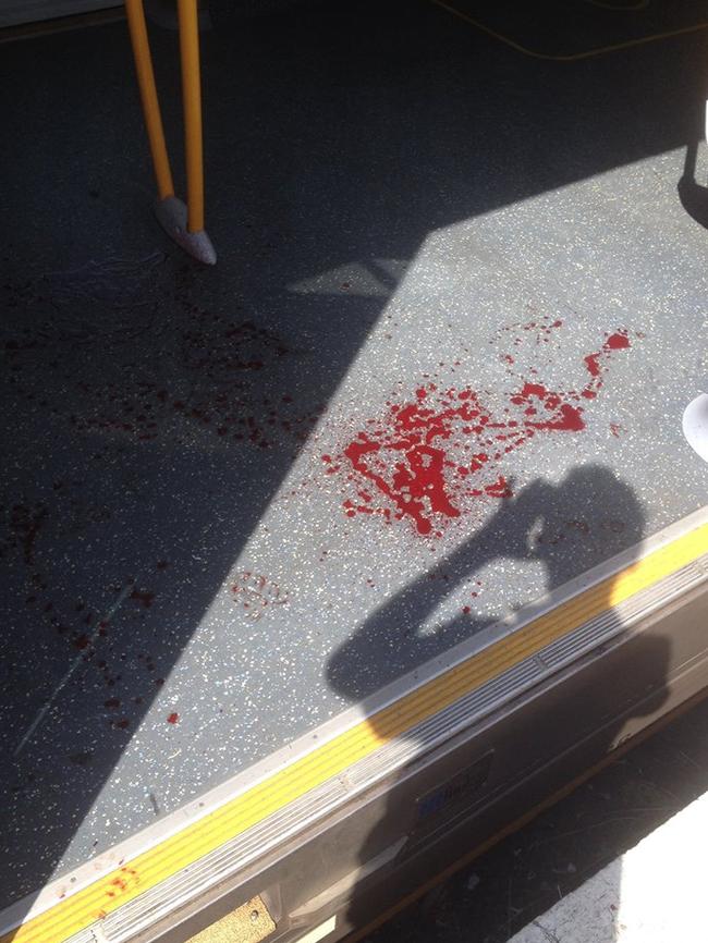 Blood on carriage floor. Picture: Brett Saunders