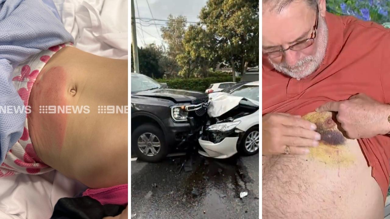 Photos of the injuries have come to light. Photo: 9News Queensland and Twitter, @BaileyKenzie9.