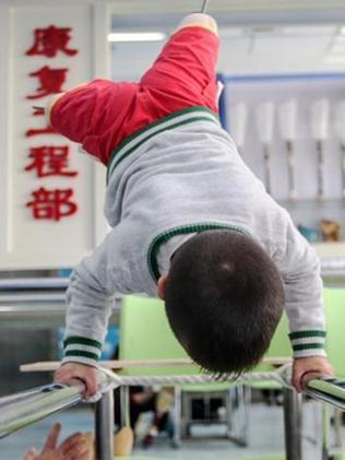 Pic shows: Toddler Xiaofeng is learning to walk againg after being fitted with his first pair of temporary prosthetics. A double amputee toddler, who shot to fame and won the hearts of the nation when he danced to a famous Chinese pop song, is learning to walk again after being fitted with his first pair of temporary prosthetics. Brave Four-year-old Xiaofeng had both his legs amputated, following a car accident two years ago in his hometown of Enshi, a city in central Chinaâ€™s Hubei Province. After multiple operations, he is now undergoing rehabilitation with prosthetics. In March, Xiaofeng was transferred to the Disabled Rehabilitation Center in provincial capital Wuhan, where physicians have been preparing him to walk once more. Doctors said Xiaofeng, who cried when doctors fitted plaster on his legs to make a mould for his prosthetics, has been more at ease at the rehabilitation centre, as the crowded hospital where he had his operations often made him nervous and quiet. The boy who moved people across China when he danced to the famous Chopstick Brothers pop song 