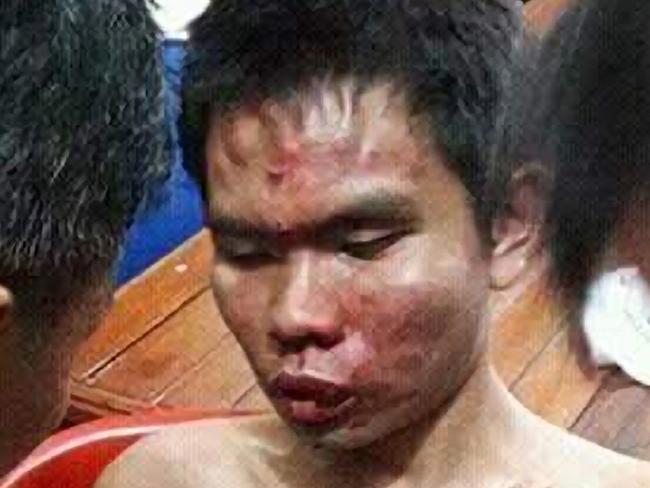 The alleged bomber after the attack at the Roman Catholic St Joseph Church in Medan, North Sumatra province, in Indonesia. Credit: Facebook