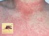 ‘Major epidemic’: Horror virus explodes