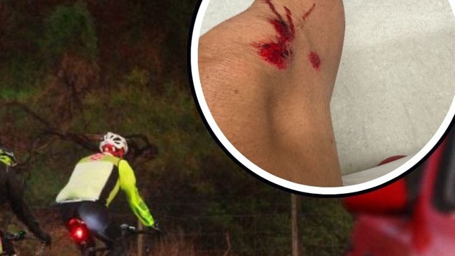 A professional athlete in Cairns is calling for the revival of campaigns like ‘Share the Road’, after he was struck by a vehicle in a hit-and-run incident Thursday morning in Trinity Park. Picture: Supplied.