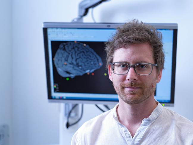 Dr Luca Cocchi, head of QIMR Berghofer Medical Research Institute's clinical brain networks team. Picture: Tony Phillips