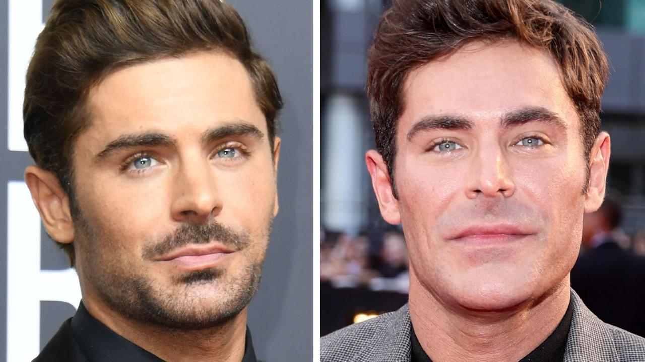 Zac Efron makes first red carpet return after broken jaw Photos