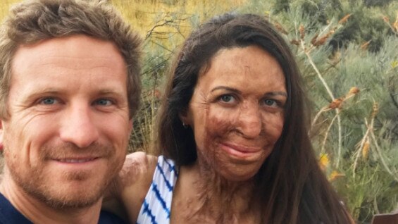 Turia Pitt and her husband Michael Hoskin. Picture: Instagram