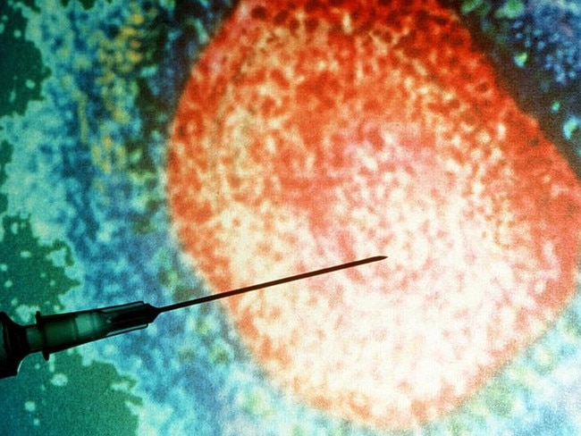 Measles generic.  Picture: Getty