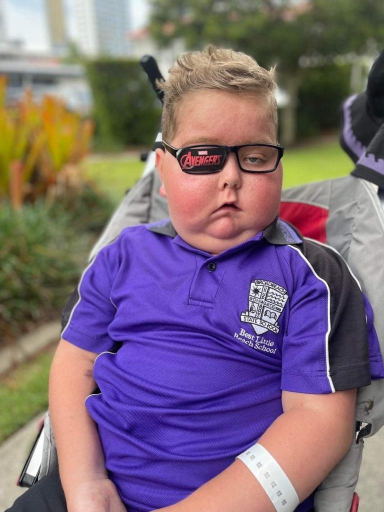 Ryley just before his death, his face swollen by steroid treatment.