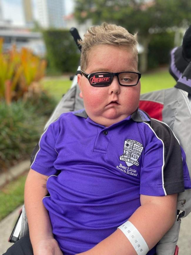 Ryley just before his death, his face swollen by steroid treatment.