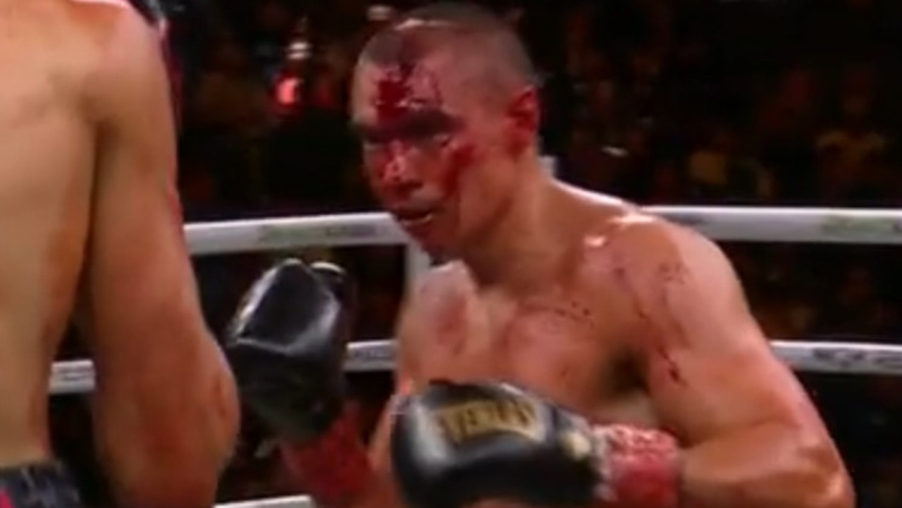 Tszyu was a bleeding mess in the fourth round. Photo: Fox Sports