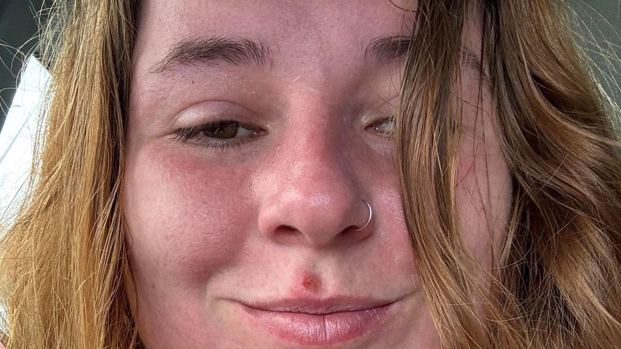 Reason behind woman’s red-faced selfie