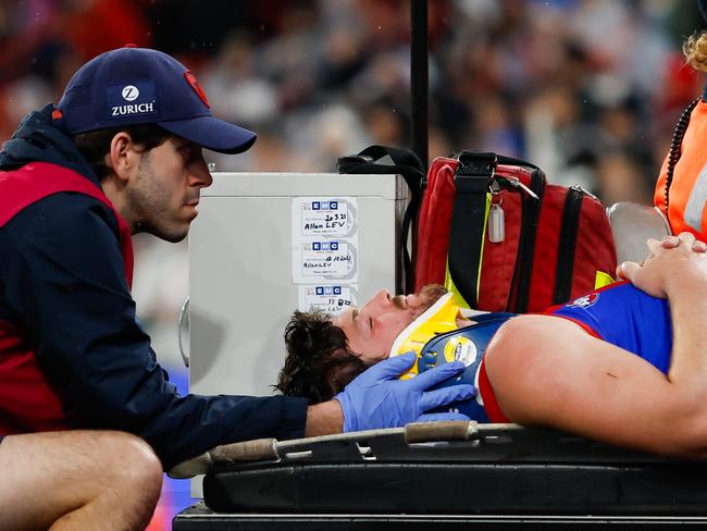 MELBOURNE, AUSTRALIA - SEPTEMBER 07: Angus Brayshaw of the Demons leaves the field on a stretcher during the 2023 AFL First Qualifying Final match between the Collingwood Magpies and the Melbourne Demons at Melbourne Cricket Ground on September 07, 2023 in Melbourne, Australia. (Photo by Dylan Burns/AFL Photos via Getty Images)