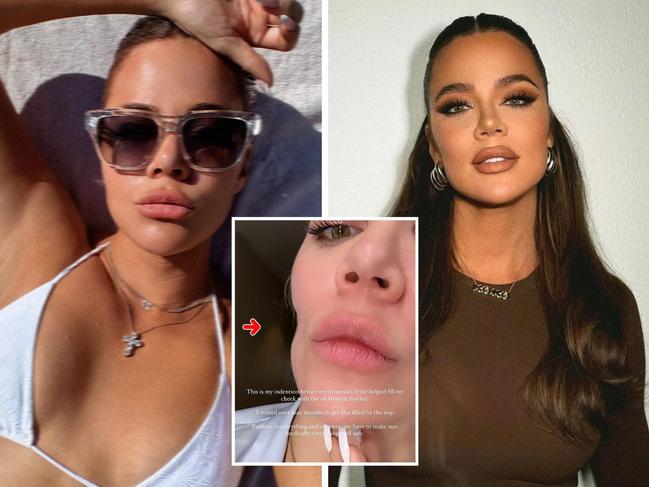 Khloe Kardashian has shocked fans with before-and-after photos following the removal of a skin cancer from her cheek. Picture: Supplied