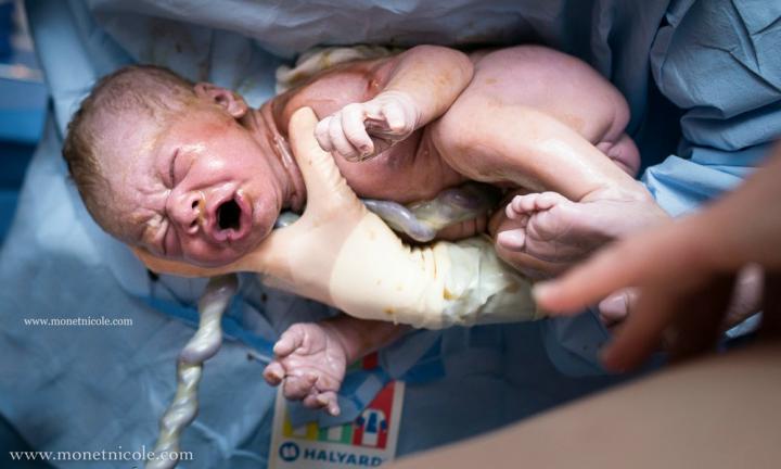 17 Stunning Birth Photos That Change the Way We See Umbilical