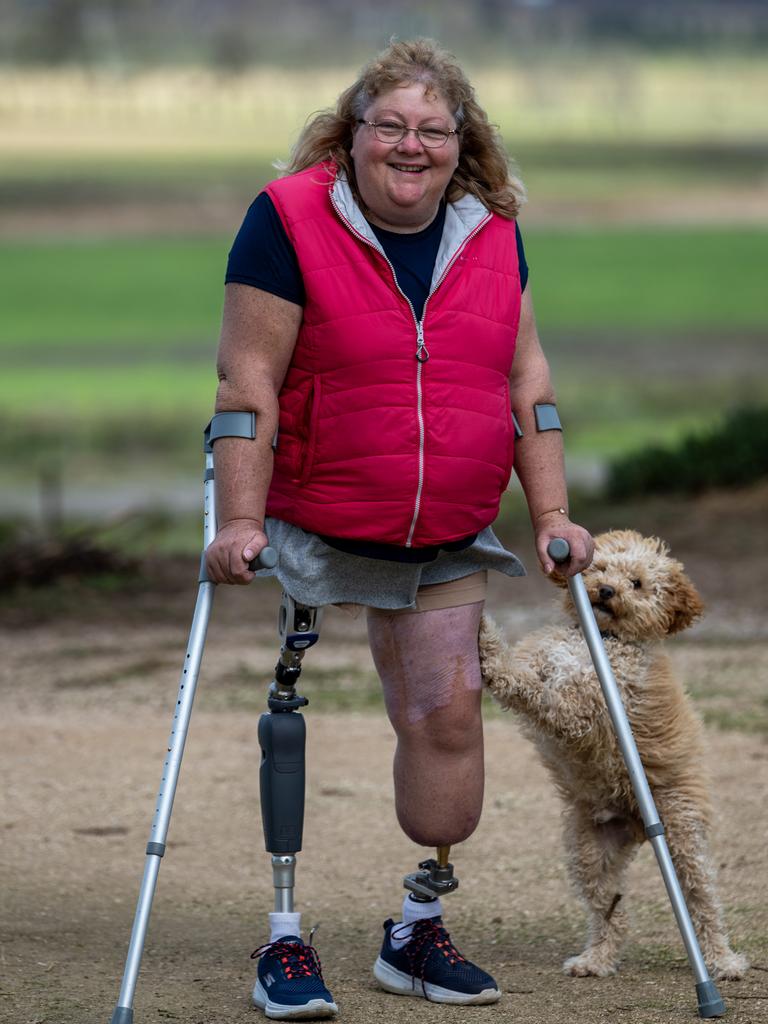 Kerrie McDonald lost her legs after her pet lamb rammed into her. Picture: Naomi Jellicoe