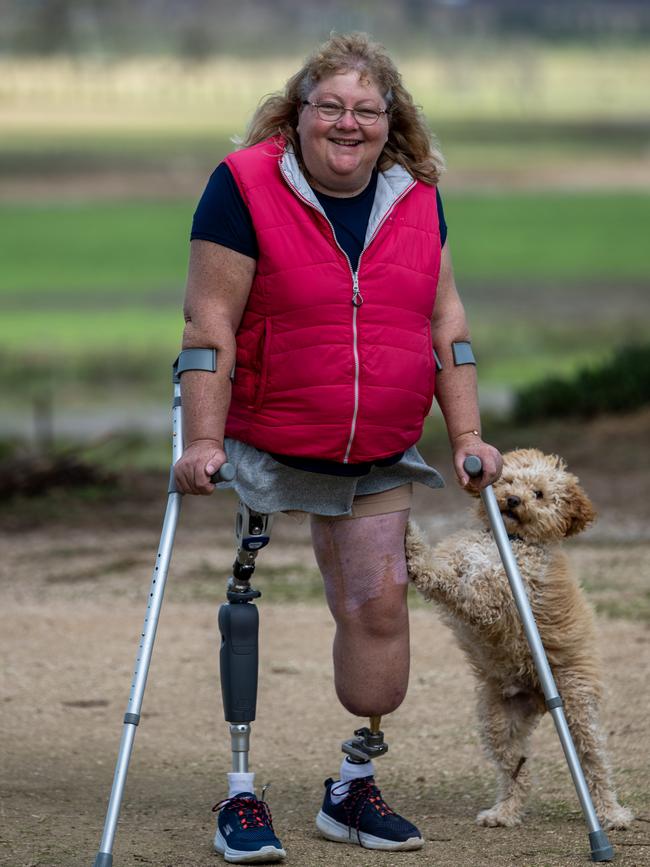 Kerrie McDonald lost her legs after her pet lamb rammed into her. Picture: Naomi Jellicoe