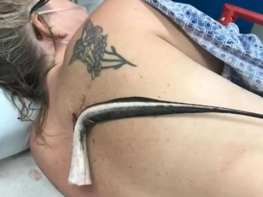 Cataffo-Obrien and her husband were relaxing in the water when she was impaled by the stingray.