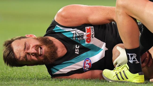 Charlie Dixon grimaces after breaking his leg against West Coast in 2018. Picture: Daniel Kalisz (Getty Images)