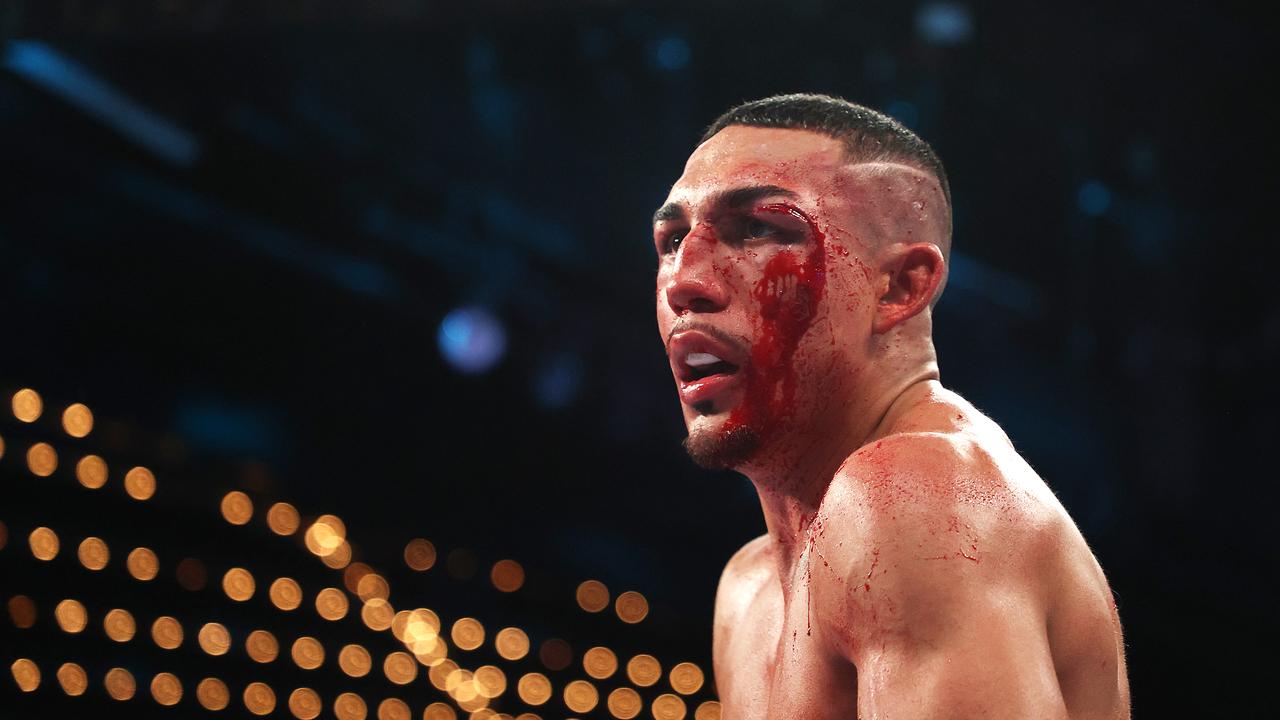 Teofimo Lopez was bloodied and battered during his bout against George Kambosos. Photo by Al Bello/Getty Images