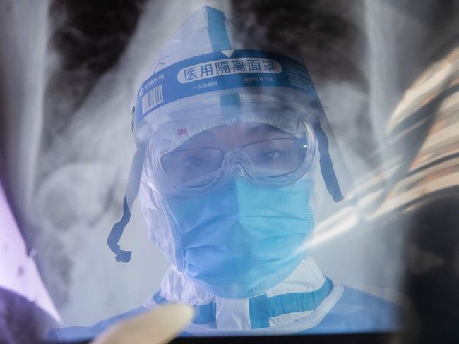 This photo taken on February 22, 2020 shows a doctor looking at X-ray film at a hospital in Wuhan in China's central Hubei province. - Authorities in Wuhan on February 24 reversed a decision that would have allowed some people to leave the quarantined city at the centre of China's deadly virus epidemic. (Photo by STR / AFP) / China OUT