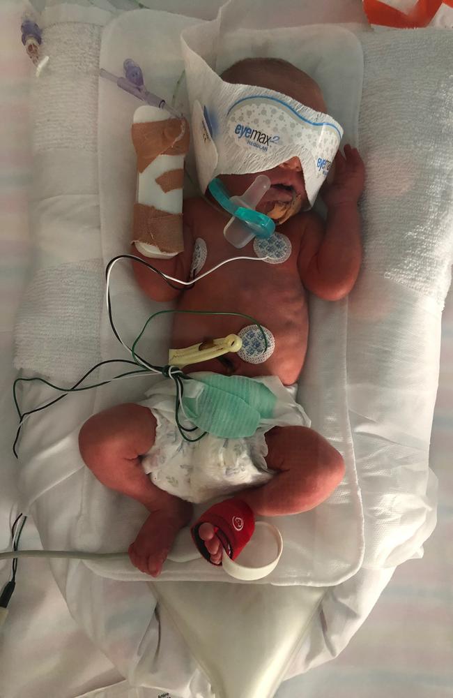 Ellis was one of almost 1000 babies born premature at the Royal. In Australia, premature births account for about eight per cent of all newborns coming into the world. Picture: Supplied