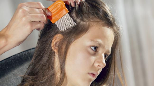 Head lice: every parent’s nightmare. Picture: Stock image