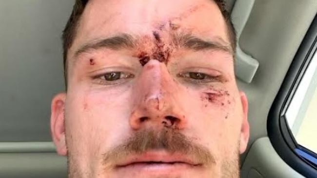 Six out of seven charges against Raiders player Tom Starling have been dropped after an incident with police on the Central Coast.