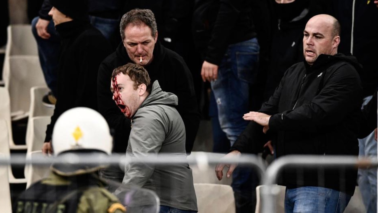 It was a gruesome scene as fans clashed with riot police officers