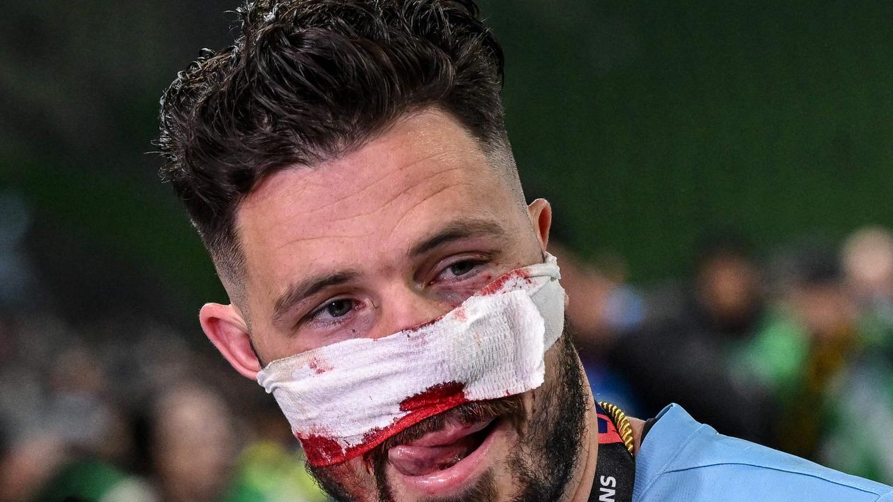 Leckie needs ‘really good break’, out of Socceroos squad