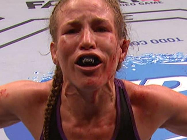 Female UFC fighter almost loses ear