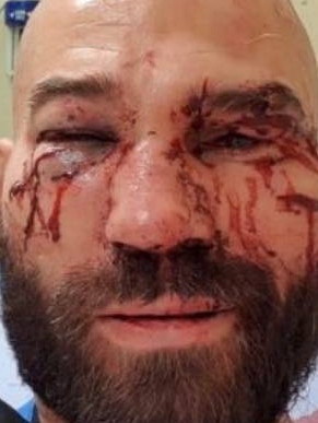 Knight beat former Conor McGregor sparring partner Artem Lobov. Picture: Supplied