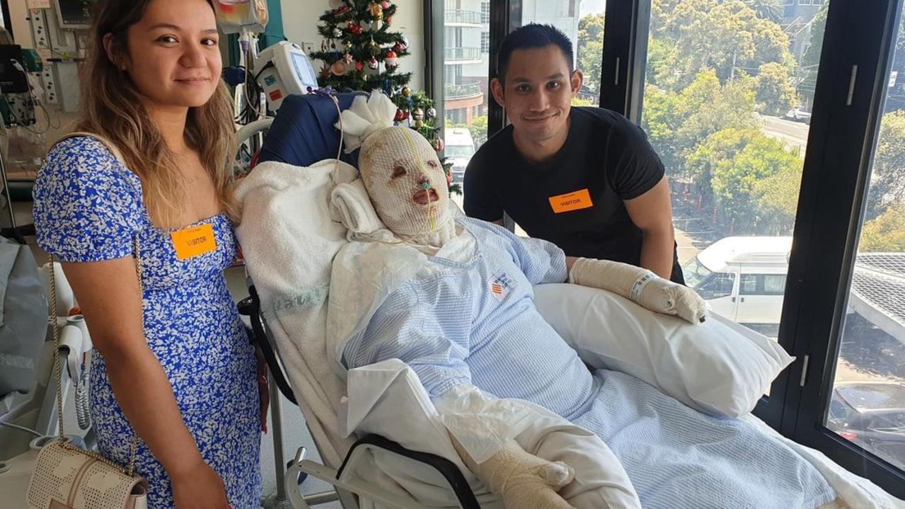 White Island Volcano Survivor Stephanie Browitt Removes Her Mask The