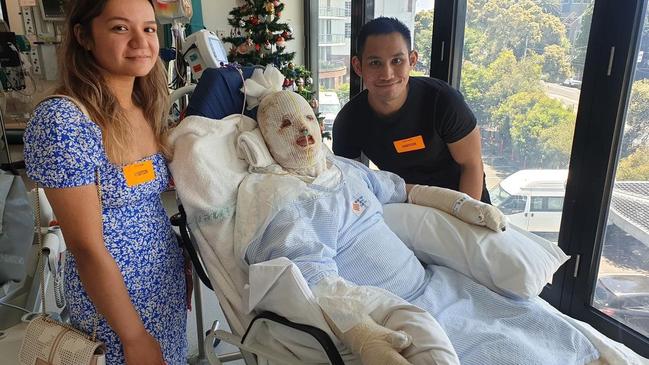 The White Island survivor when she woke from her coma. Picture: Instagram