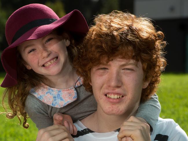 Charlie Harms, 14, has recovered after brain surgery a fortnight ago at the RCH. Charlie with his sister Milli (7). Picture Jay Town.