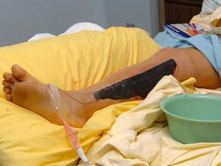 Aleta Lederwasch’s injured leg.