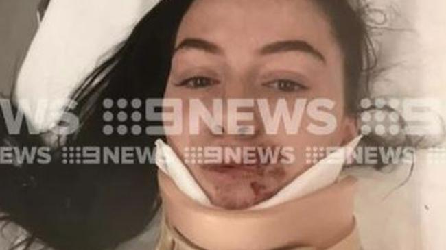 Frankston Melbourne Carjacking Teenager Beaten After Car Crash Au — Australias
