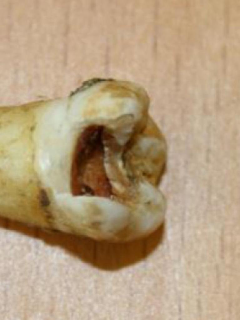 John Lennon's tooth. Picture: Omega Auction House