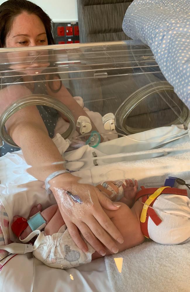 Ash in his isolation crib. The twins were taken away after being born as they both needed help with breathing.